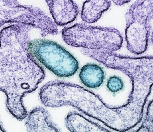 한국, 니파 바이러스 ‘제1군 감염병’ 지정… 최고 수준 대응 체계 가동 a close up of an animal cell with blue cells